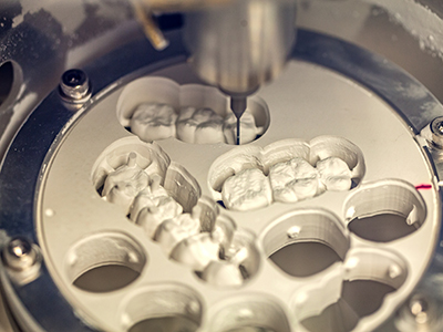 Crown Point Smiles | Extractions, All-on-4 reg  and Sedation Dentistry