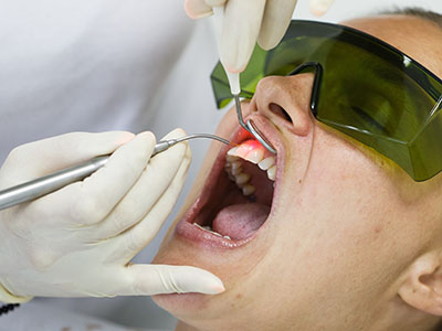 Crown Point Smiles | Sports Mouthguards, CBCT and Extractions